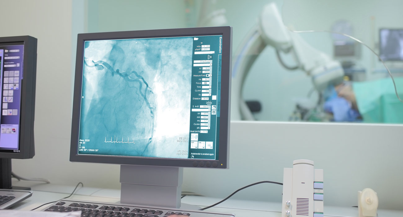 Interventional Cardiology